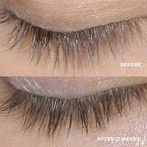 Lash Serum